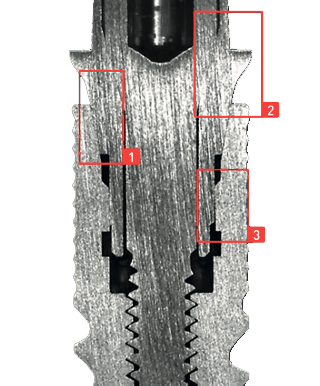 MEDENTiKA ABUTMENT CX 1200 * kompatibel mit Medentis Medical® / ICX®