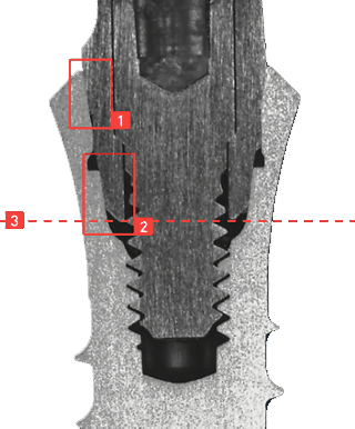 Schnittbild_Abutment_N-Serie, kompatibel mit Straumann Tissue Level